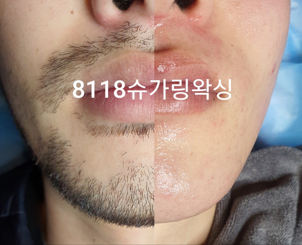 자영업자홍보방.일산.파주.김포.경기79양띠.리뉴메디.뷰티 : BAND Page
