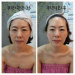 바른체형뷰티샵 이미지